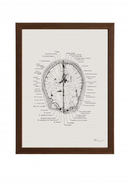 The Intricate Brain Poster- The Intricate Brain