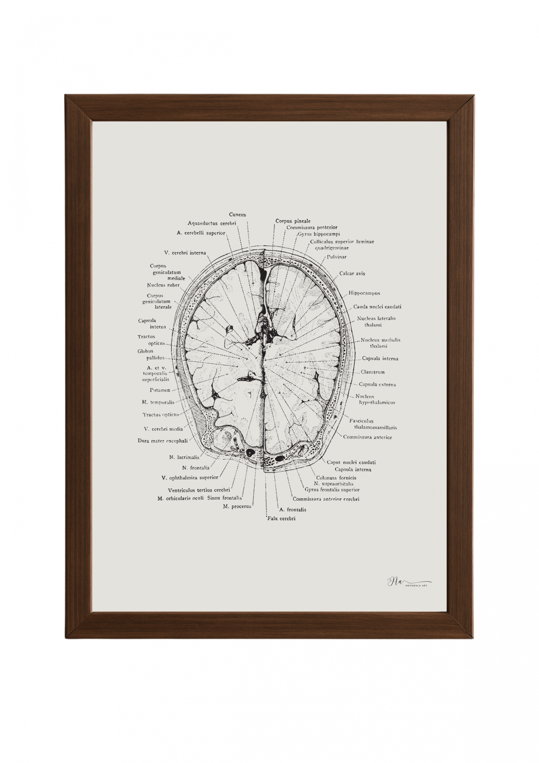 Poster- The Intricate Brain