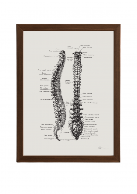 Bones of the Back: Vertebral Insights Poster- Bones of the Back: Vertebral Insights