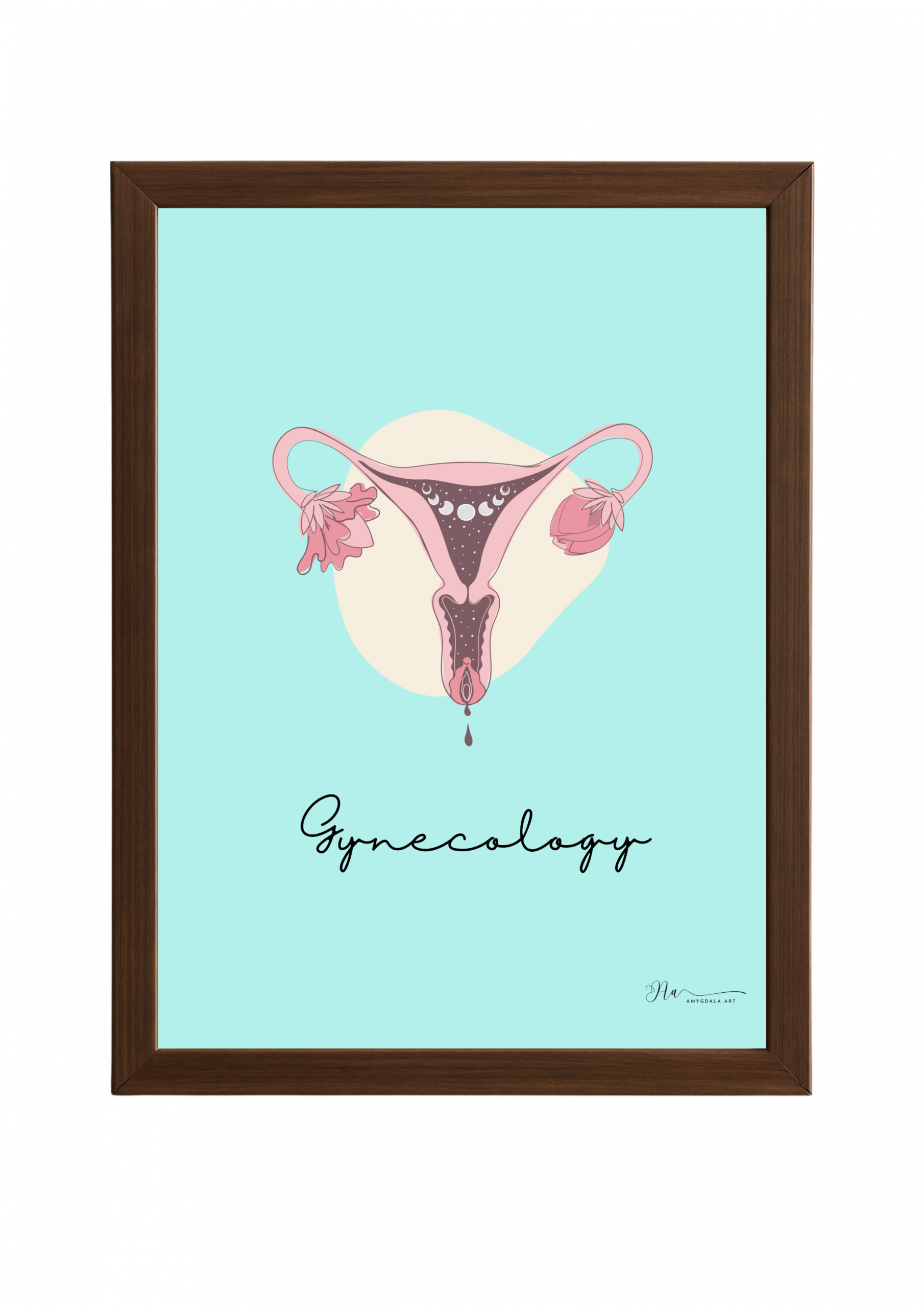 Poster- Gynecology