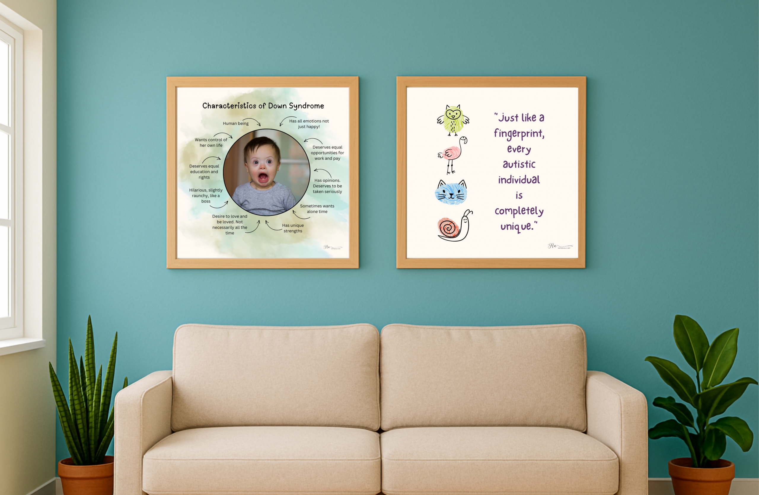 Characteristics of Down Syndrome - Image 2